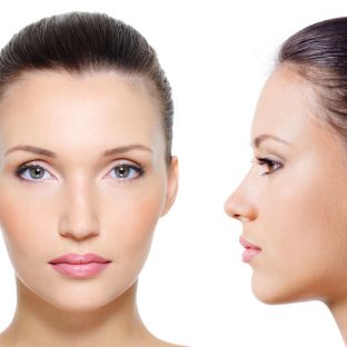 Frontoplastia, cirugía de la frente